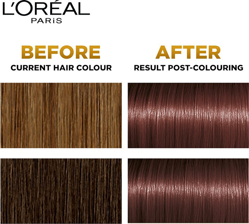Details 81+ loreal hair color choices latest in.eteachers