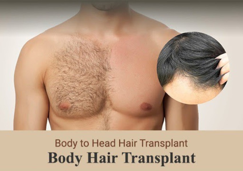 Hair Transplant Images  Free Download on Freepik