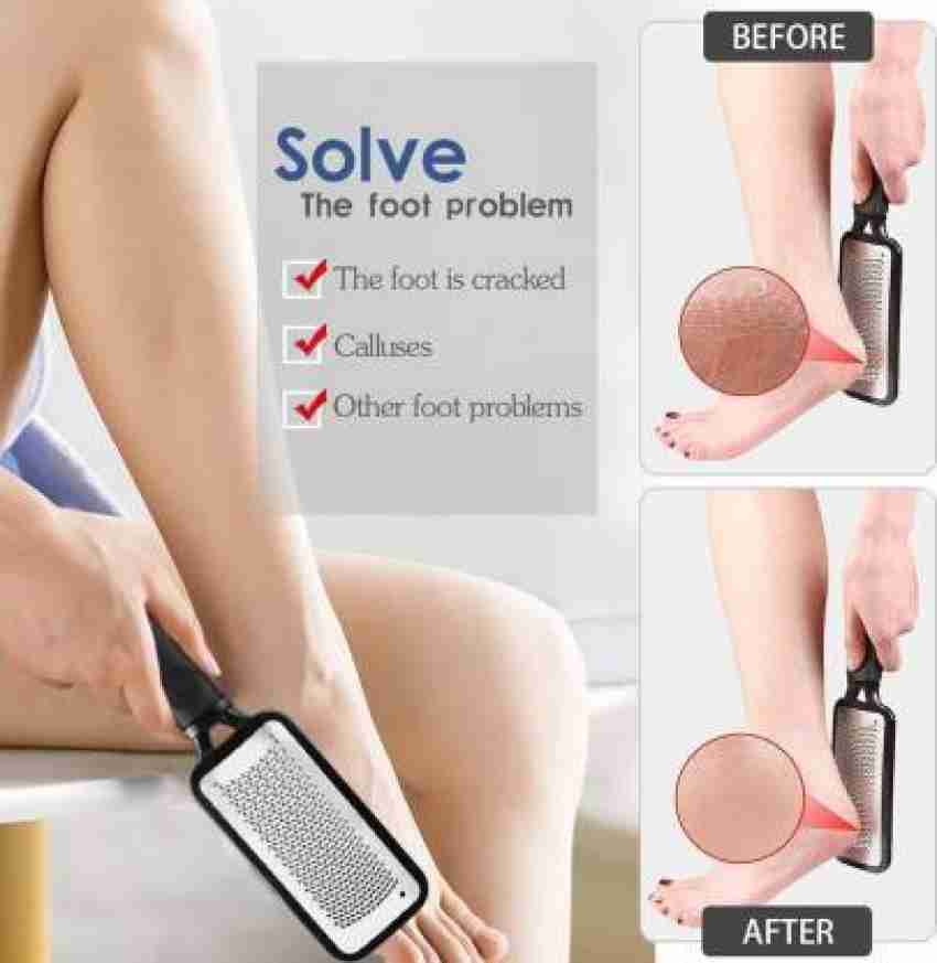 Callus Remover File Tool, Colossal Foot Rasp, Foot Scrubber, Heel Scraper, Pedicure Exfoliator to Remove Dead Hard Skin, Medical Stainless Steel Grade