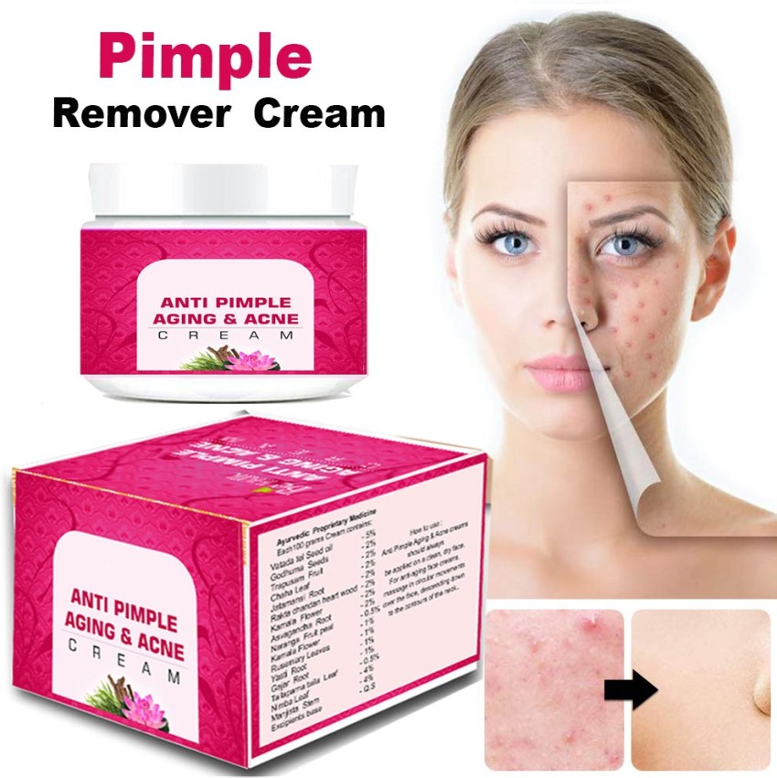 Pimple and store acne cream