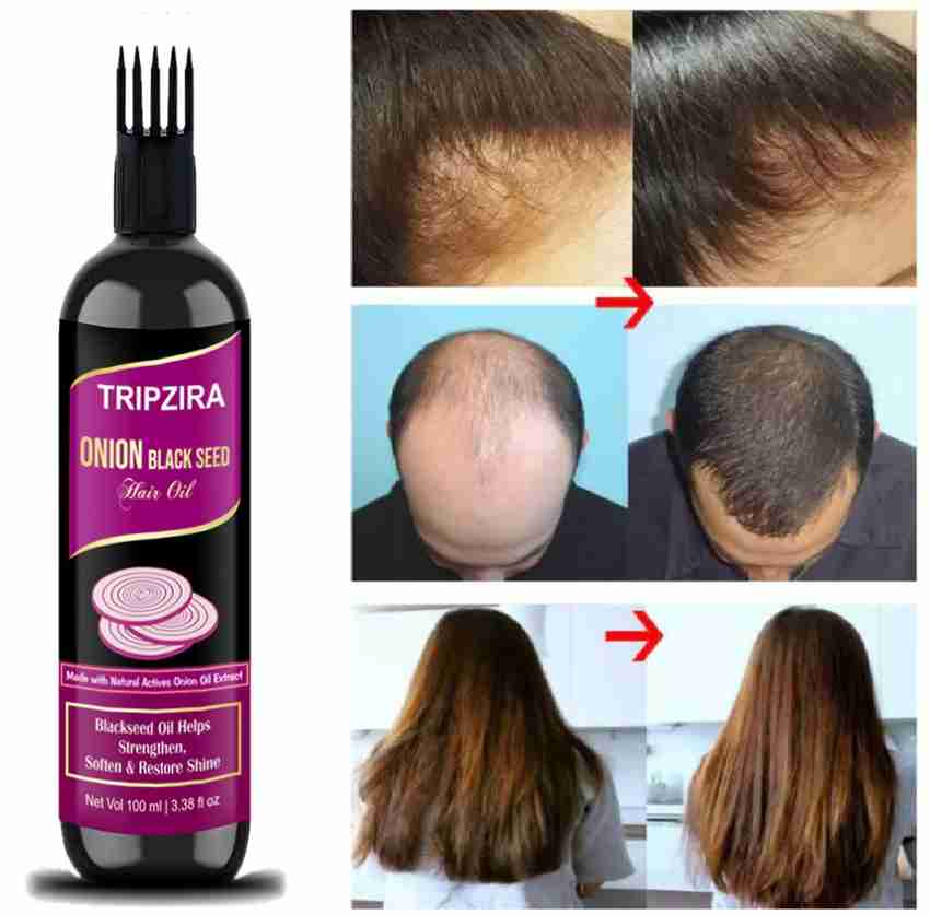 TRIPZIRA Onion Black Seed Hair Oil - Controls Hair Fall - NO Mineral Oil, Silicone 100 ml Hair Oil - Price in India, Buy TRIPZIRA Onion Black Seed Hair Oil - Controls TRIPZIRA Onion Black Seed Hair Oil - Controls Hair Fall - NO Mineral Oil, Silicone 100 ml Hair Oil - Price in India, Buy TRIPZIRA Onion Black Seed Hair Oil - Controls