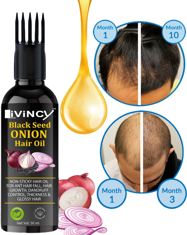 Natural Onion Hair Oil for Hair Regrowth