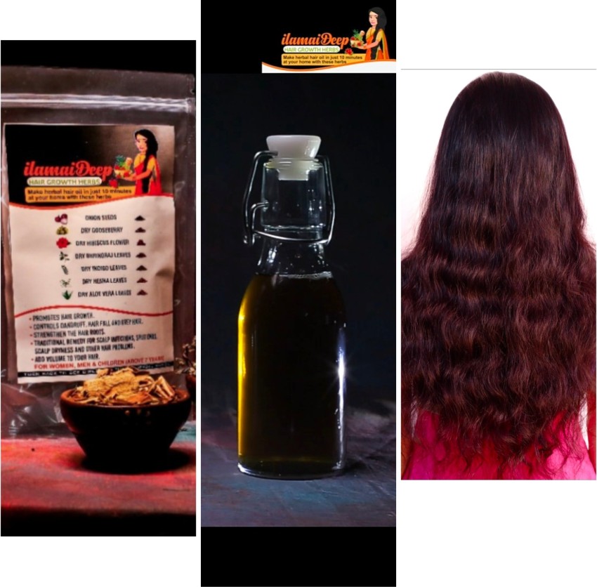 Best hair loss treatment Onion juice can help  Expresscouk