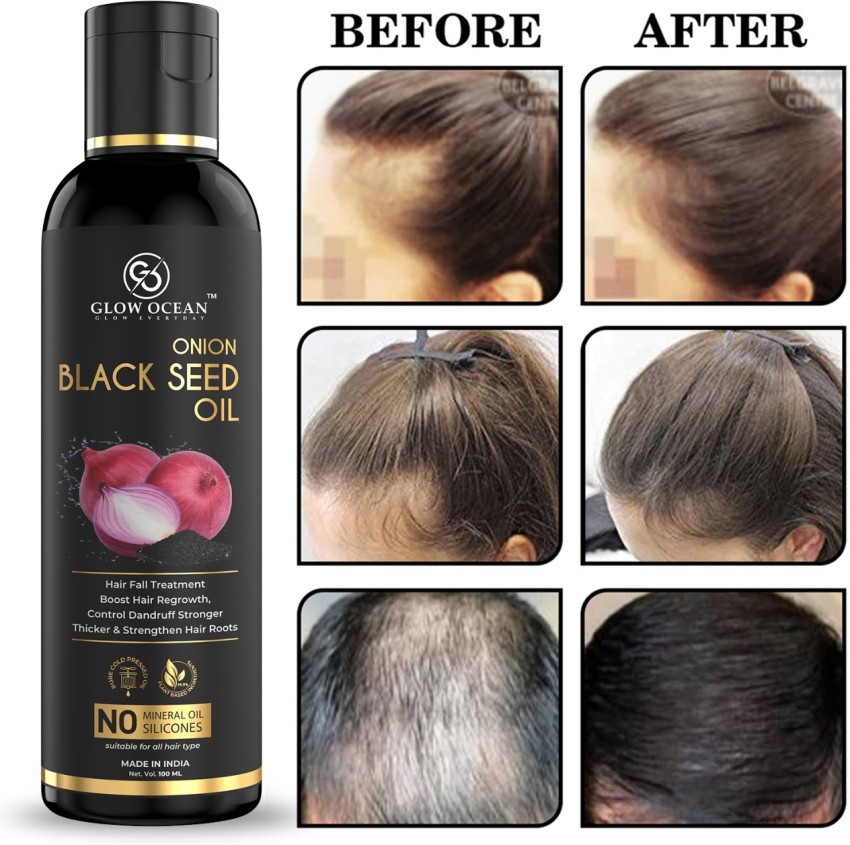 KURAIY Natural Red Onion Black Seed Hair Oil  WITH COMB APPLICATOR  NO  Mineral Oil Silicones Cooking Oil 50 ml   MEN  WOMEN  JioMart