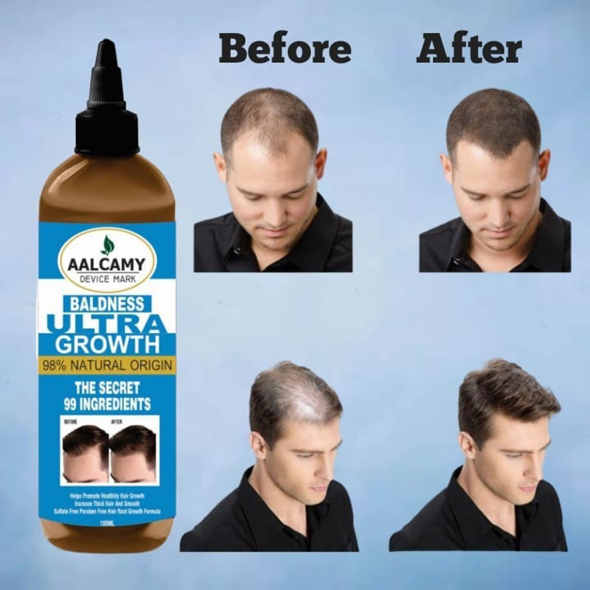Details 88+ hair growth products for men in.eteachers