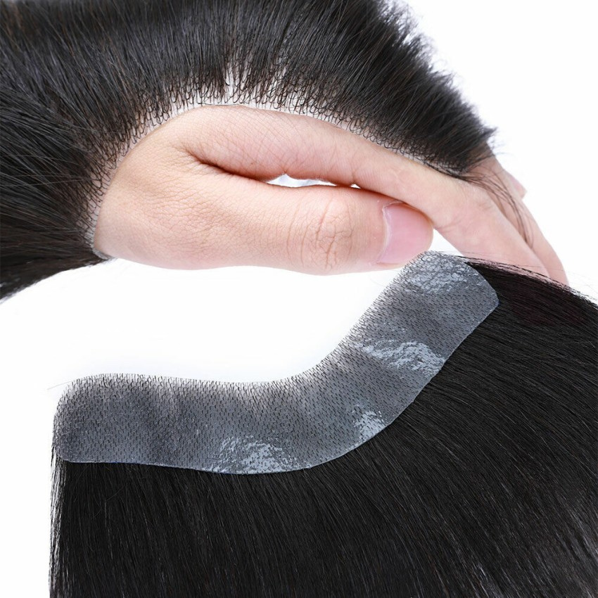Front Hairline Hair Patch Hairline Receding Solution  Customised Hairline  Patch  New Hair Image  YouTube