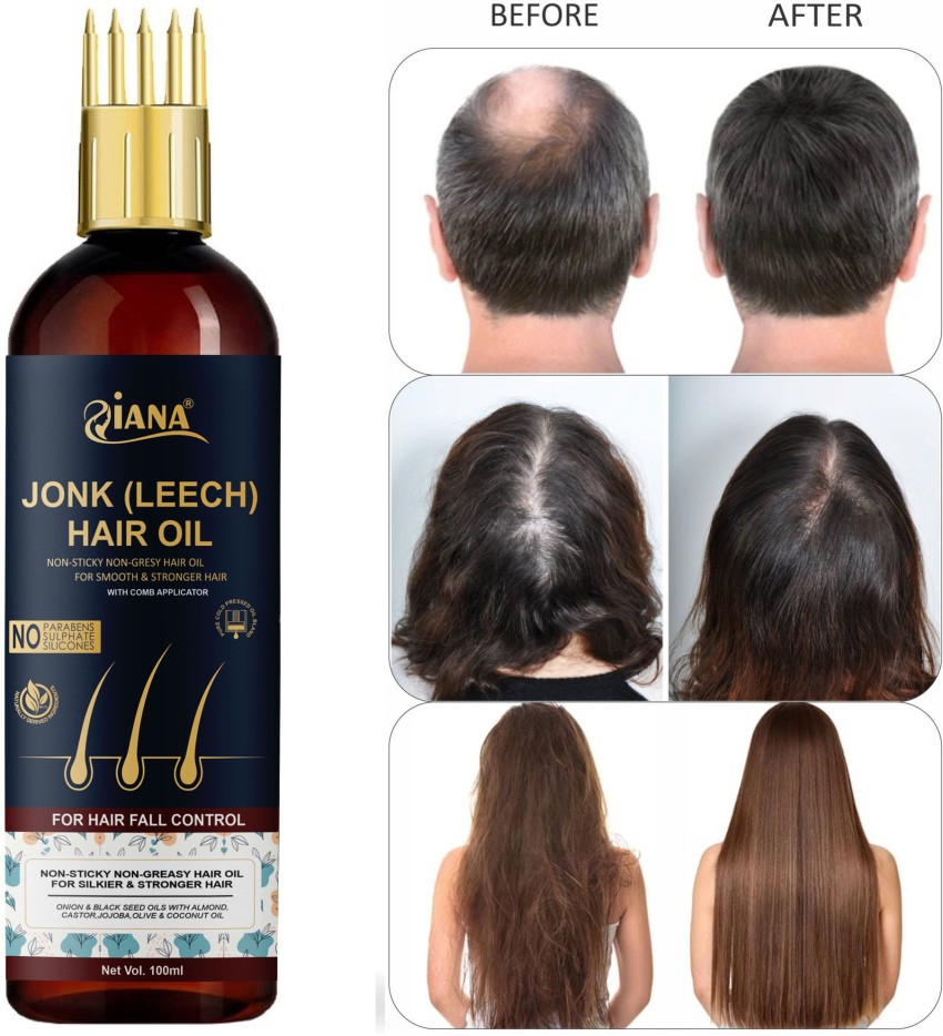 Nature Sure Combo  Jonk Tail Leech Oil 110ml and Hair Growth Oil 110ml   Amazonin Beauty