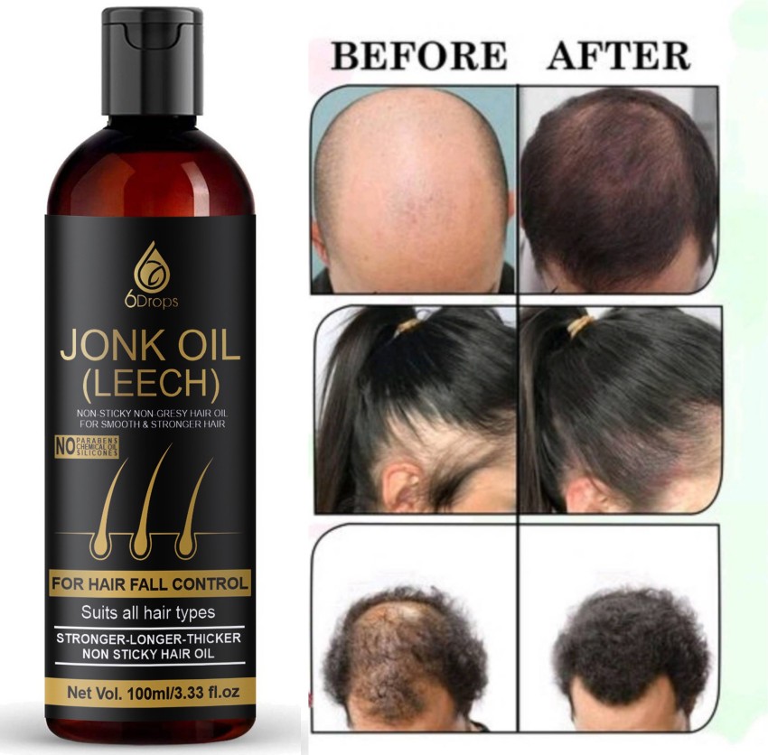 TreasureHerbs Jonk Tail Leech Oil for Growth Hair Control Hair Loss a   treasureherb