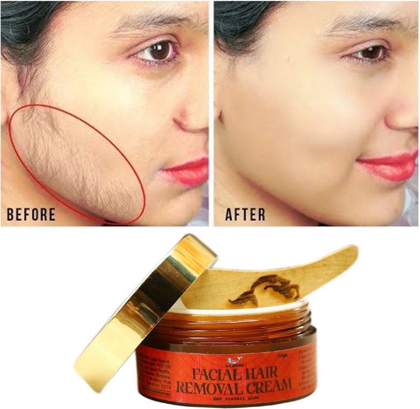 Top 69+ girl facial hair removal best in.eteachers