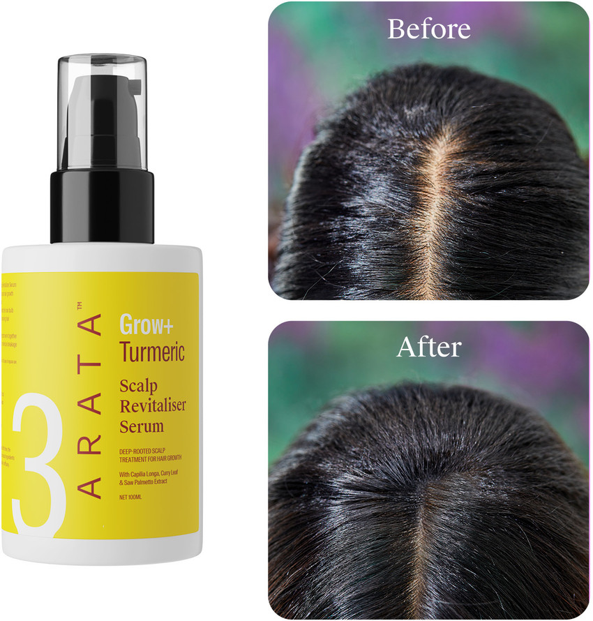 Details more than 78 curcumin hair shedding super hot in.eteachers