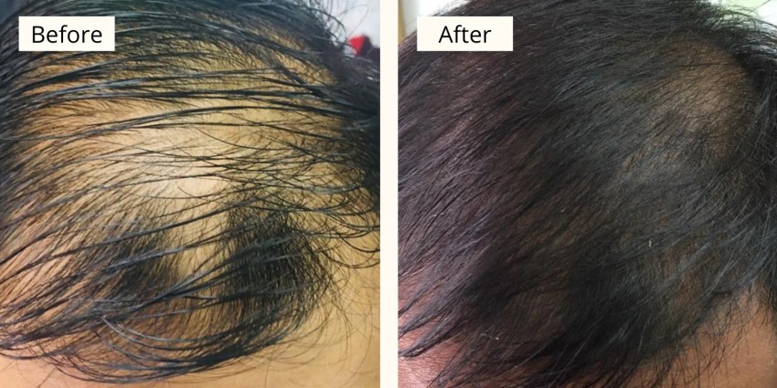 Professional Salon Barber Super Smooth Hair Care Hair Treatment Repair Dry  Split Hair Vitamin E Hair Oil Serum Soft Capsule - China Hair Vitamil E,  Vitamil E Care | Made-in-China.com