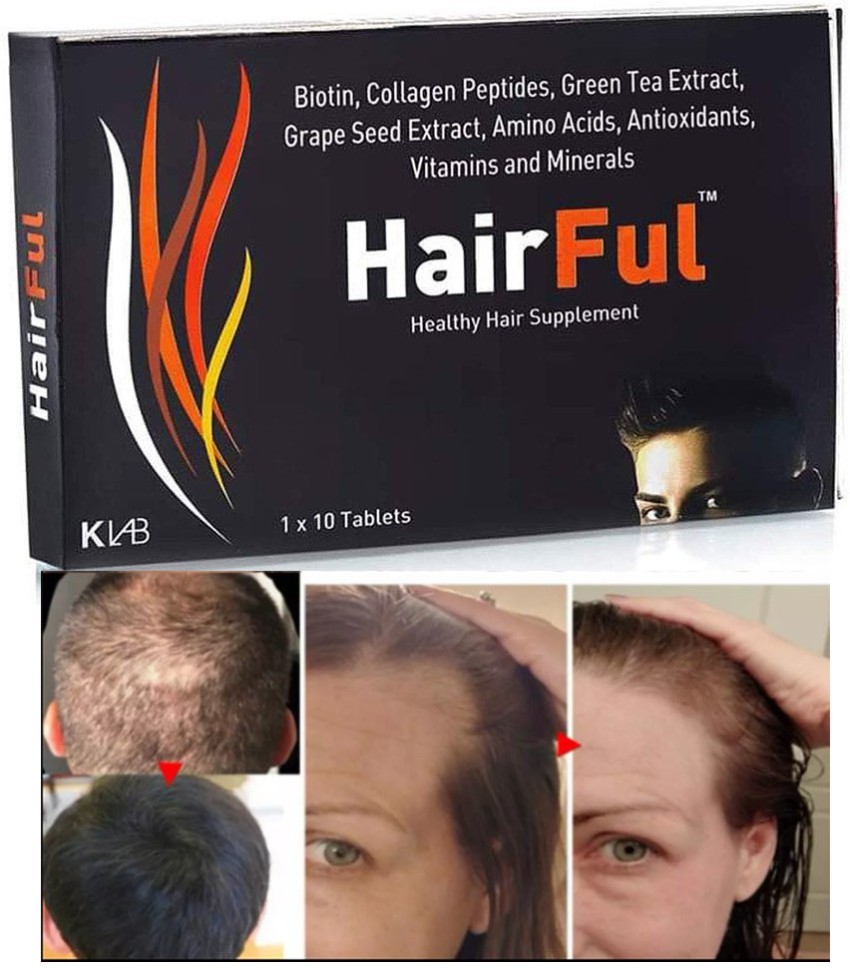Fructis Hair Serum vitamin & strength hair fall reducing, 125 mL – Peppery  Spot