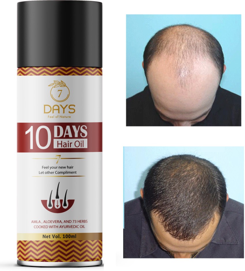 7day Ginger Hair Oil Hair Loss Treatment Fast Growing Nourishing And  Hydrating  Fruugo IN
