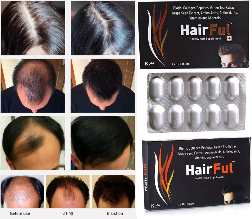 Best Hair Growth Supplements in India You can Try