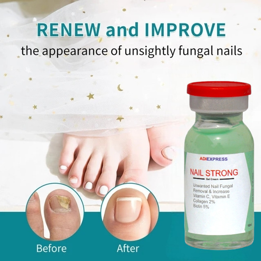 Discover more than 108 nail fungal infection medicine india super hot