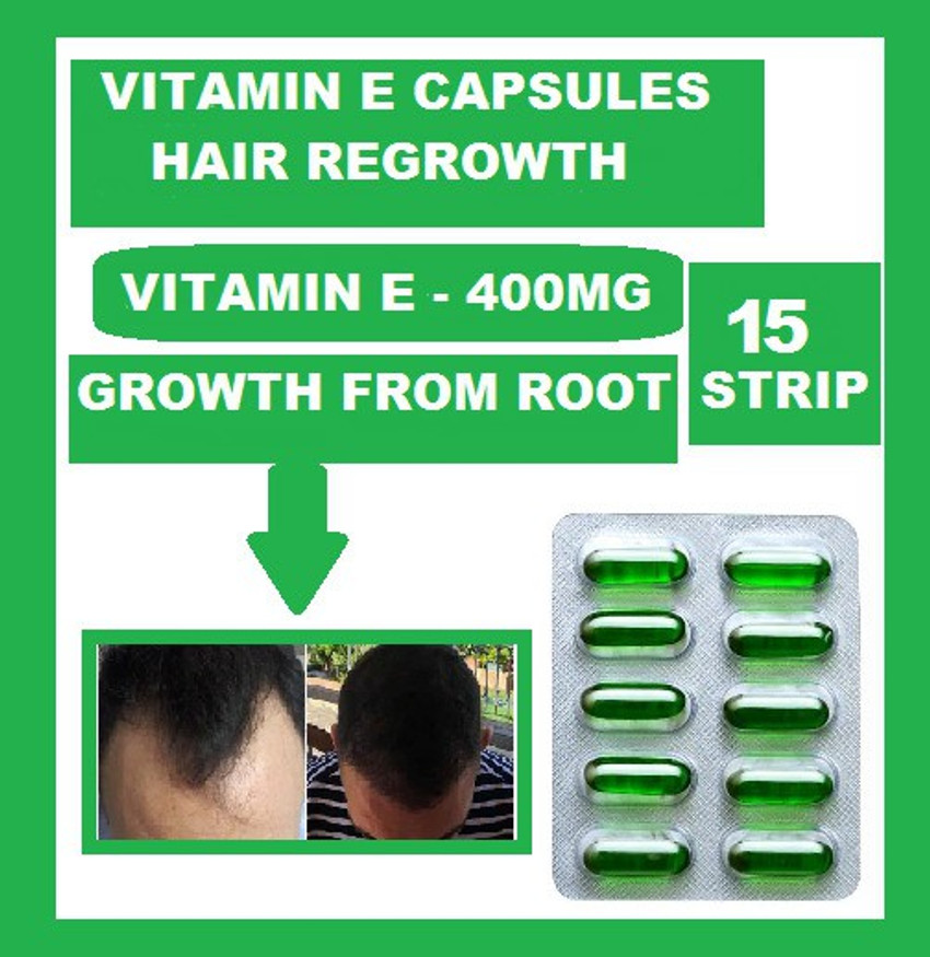 Aggregate 84+ vitamin e for hair regrowth best vova.edu.vn