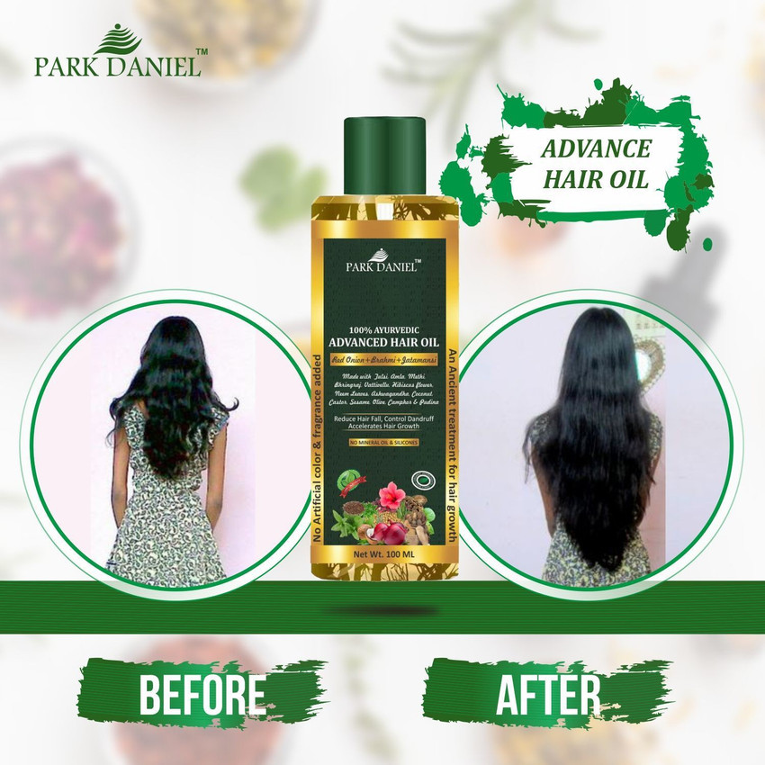 Price in India, Buy PARK DANIEL 100% Ayurvedic Advance Hair Oil- Enriched with Red Onion & other 20 Natural Oils -For Fast Hair Growth & to Reduce Hair fall(100 ml) Hair Oil Online In India, Reviews, Ratings & Features | Price in India, Buy PARK DANIEL 100% Ayurvedic Advance Hair Oil- Enriched with Red Onion & other 20 Natural Oils -For Fast Hair Growth & to Reduce Hair fall(100 ml) Hair Oil Online In India, Reviews, Ratings & Features |