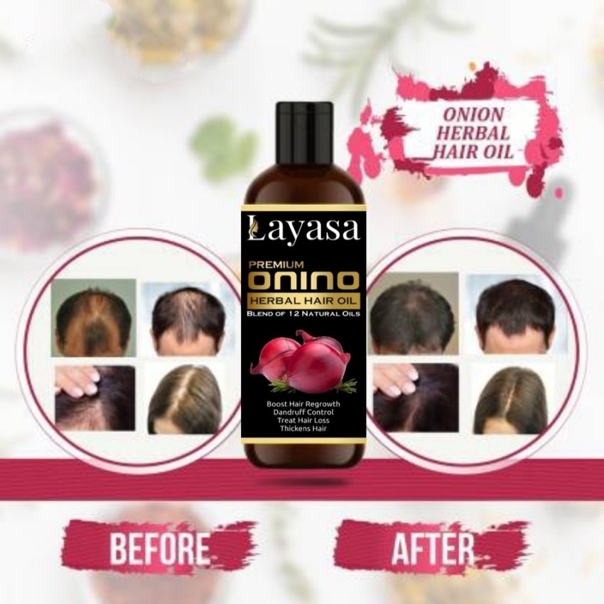 Layasa Onion Hair Oil with 14 Essential Oils for Hair Regrowth, Dandruff  Control , Black Seed - Hair Care|Growth & Shine|Tea Tree Oil|Omega-  3|Vitamin-E , For Hair Growth | Blend Of Multiple