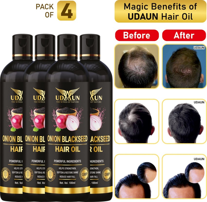 Udaun Onion Blackseed Hair Oil Pack Of 4 Hair Oil - Price in India, Buy  Udaun Onion Blackseed Hair Oil Pack Of 4 Hair Oil Online In India, Reviews,  Ratings & Features 