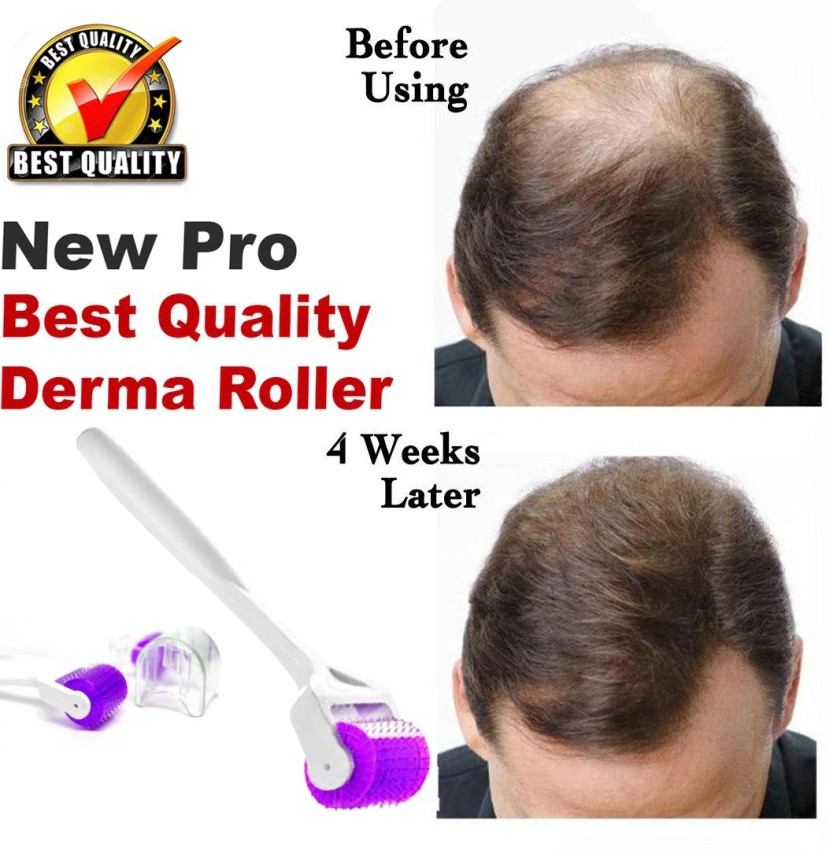 scotbeauty Derma roller hair for Acne, Skin Hair Loss hair growth titanium  roller  Price in India - Buy scotbeauty Derma roller hair for Acne,  Skin Hair Loss hair growth titanium roller