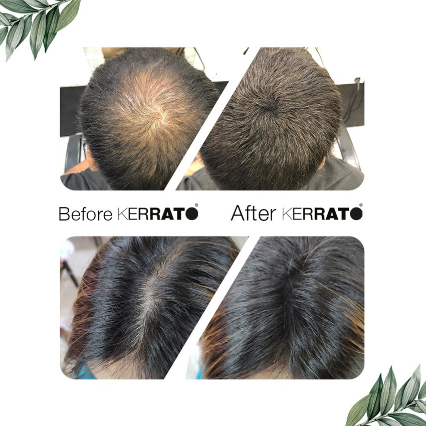 Aggregate 72+ kerrato hair fiber side effects best in.eteachers