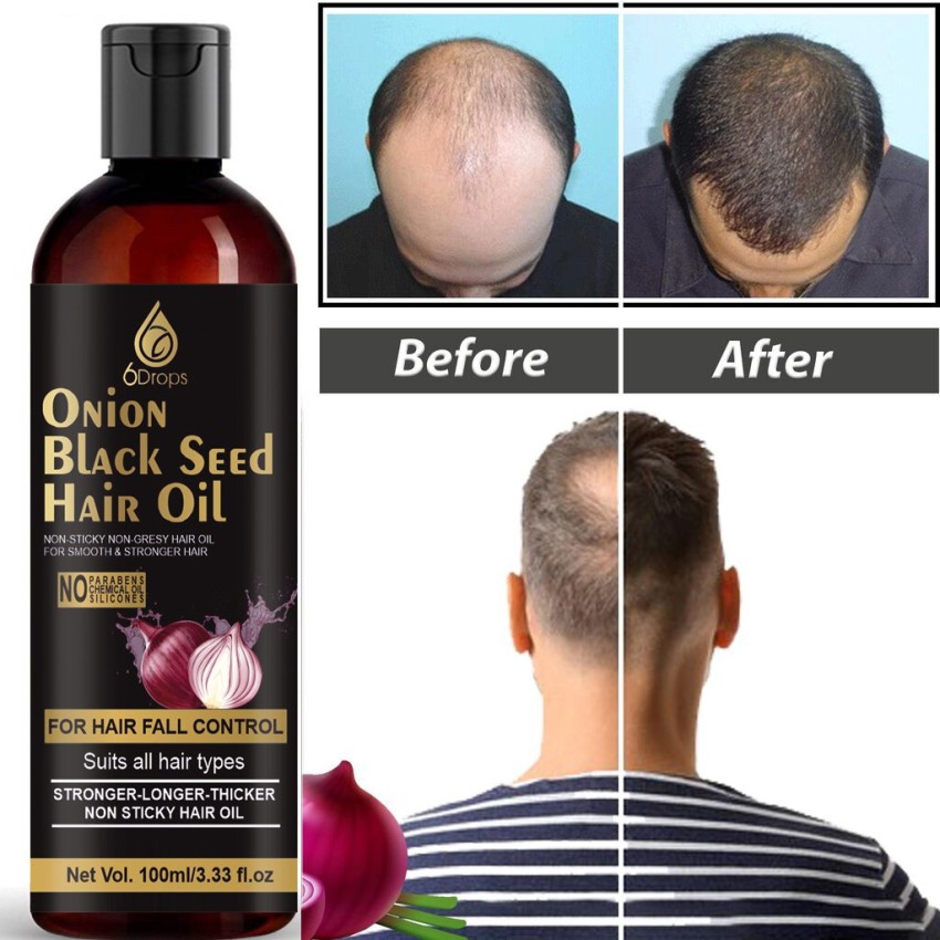 6Drops Onion Oil - Black Seed Onion Hair Oil - WITH COMB APPLICATOR - Hair  Oil - Price in India, Buy 6Drops Onion Oil - Black Seed Onion Hair Oil -  WITH