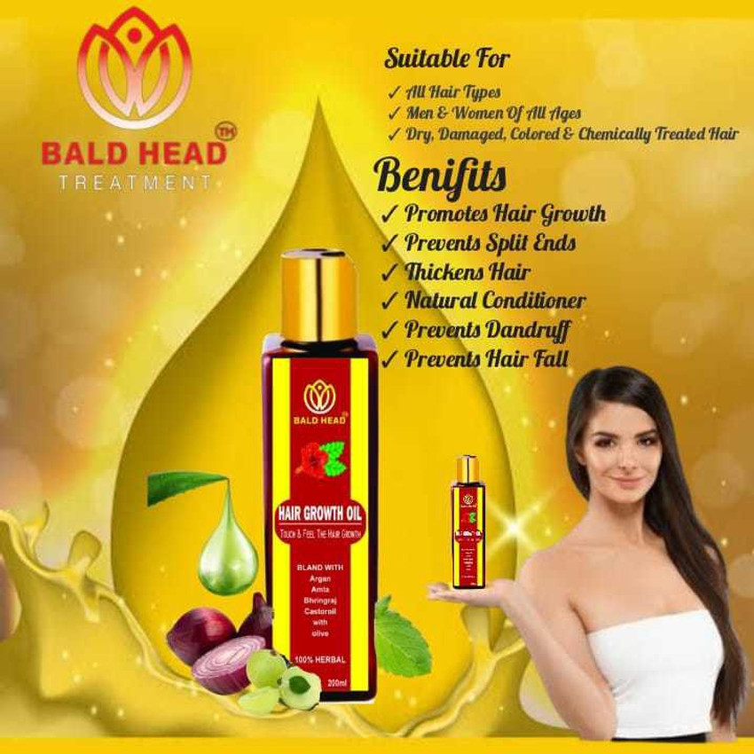 Details more than 76 bald hair growth oil best in.eteachers
