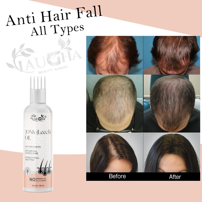 Intimify Jonk hair oil Hair growth oil Leech hair oil for men  women  develops new hair and promotes hair growth 120ml pack of 1