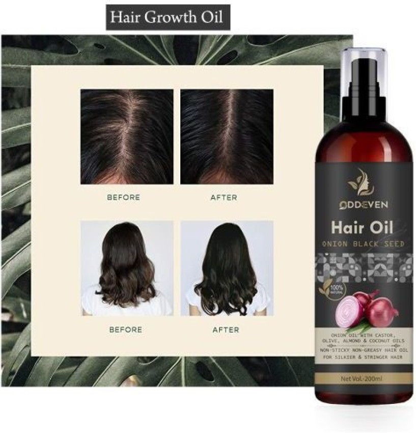 GROOVY Onion Fast Hair Growth Oil 200ml - With Comb Applicator - New Lanch  New Year Hair Oil Price in India - Buy GROOVY Onion Fast Hair Growth Oil  200ml - With