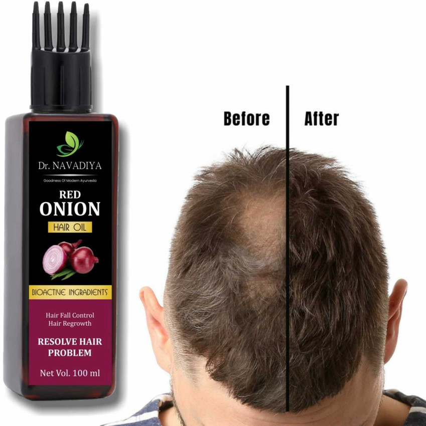 Share more than 116 dr hair growth lotion best ceg.edu.vn