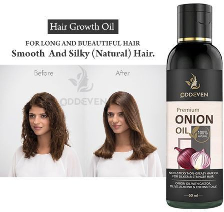 Aggregate more than 83 omega 3 hair growth latest in.eteachers