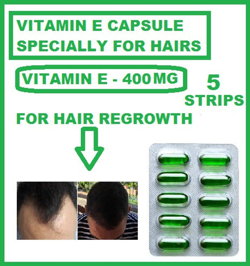 gementis VITAMIN E CAPSULE SPECIEFIC FOR HAIR LOSS PREVENTION AND REGROWTH OF HAIR Price in India - Buy gementis VITAMIN E CAPSULE SPECIEFIC FOR HAIR LOSS PREVENTION AND REGROWTH OF gementis VITAMIN E CAPSULE SPECIEFIC FOR HAIR LOSS PREVENTION AND REGROWTH OF HAIR Price in India - Buy gementis VITAMIN E CAPSULE SPECIEFIC FOR HAIR LOSS PREVENTION AND REGROWTH OF