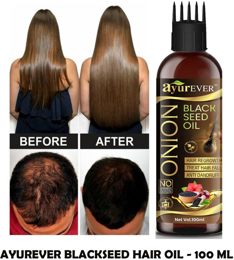 AyurEver Onion Black Seed Hair Oil - WITH COMB APPLICATOR - NO Parabens, Sulphate (100ml) Hair Oil - Price in India, Buy AyurEver Onion Black Seed Hair Oil - WITH COMB APPLICATOR - AyurEver Onion Black Seed Hair Oil - WITH COMB APPLICATOR - NO Parabens, Sulphate (100ml) Hair Oil - Price in India, Buy AyurEver Onion Black Seed Hair Oil - WITH COMB APPLICATOR -